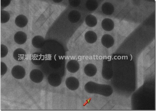 BGA因為焊墊變小，造成錫膏過多而最終形成焊接短路的結果。